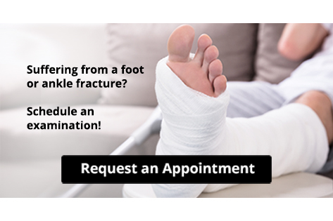 Get Professional Care for a Broken Foot or Ankle - Blog